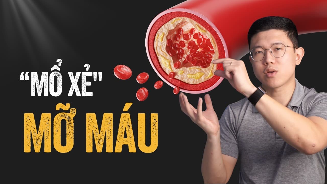 "Mổ xẻ" mỡ máu — LDL cholesterol có phải là toàn bộ câu chuyện?